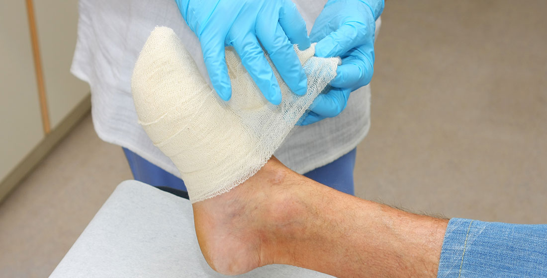 Doctor wrapping wound on foot